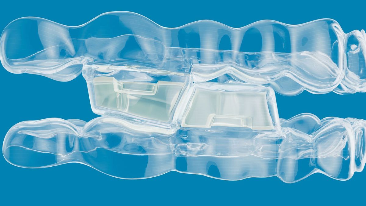 Align: Neue Invisalign Lösung für Klasse-II-Korrektur